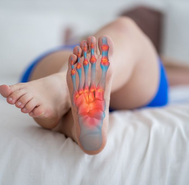 plantar-fasciitis-img-3